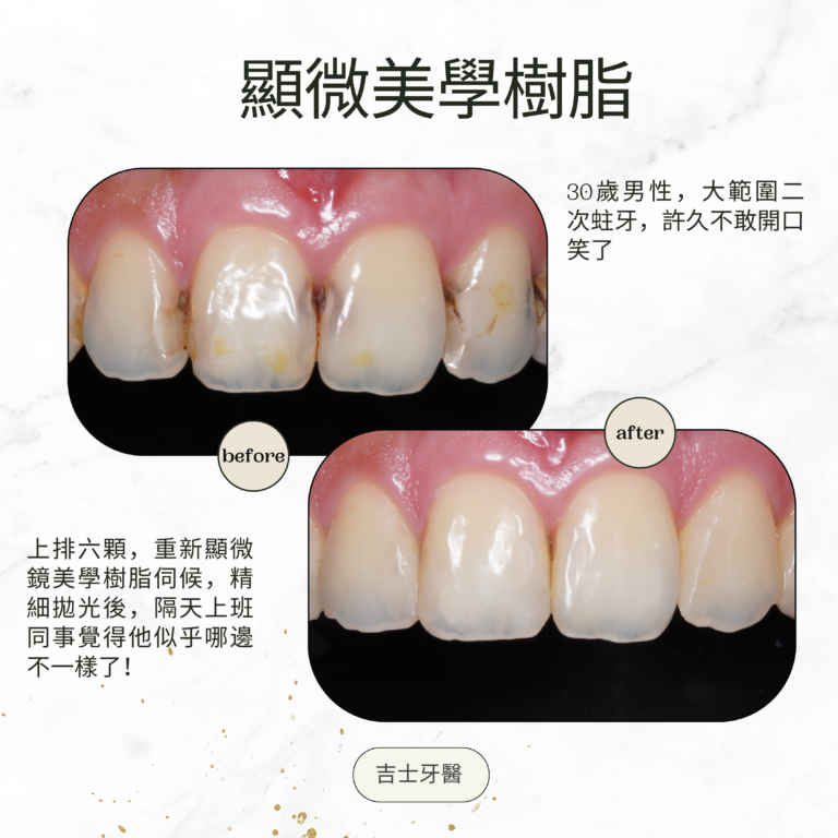 Green and Gold Elegant Skincare Before After Instagram Post (10)