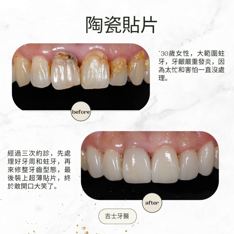 Green and Gold Elegant Skincare Before After Instagram Post (6)