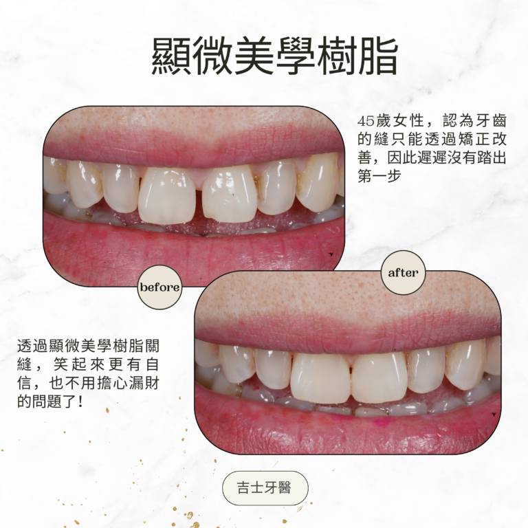 Green and Gold Elegant Skincare Before After Instagram Post