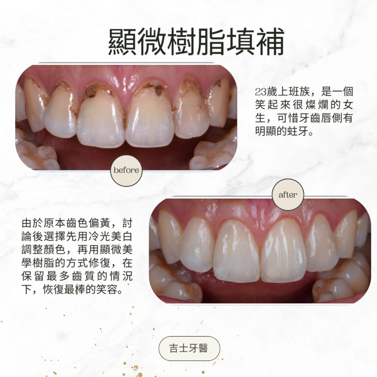 Green and Gold Elegant Skincare Before After Instagram Post (2)