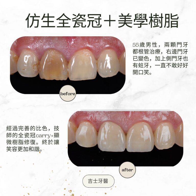 Green and Gold Elegant Skincare Before After Instagram Post (3)