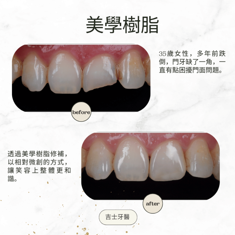 Green and Gold Elegant Skincare Before After Instagram Post