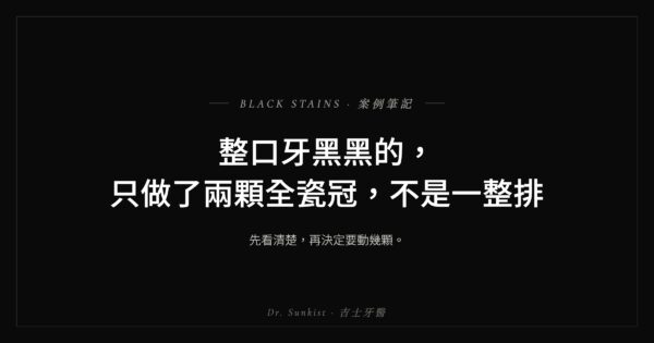 整口牙黑黑的,只做了兩顆全瓷冠,不是一整排|吉士牙醫案例