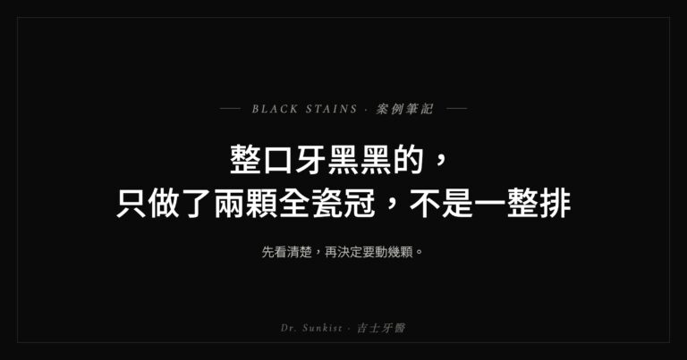 整口牙黑黑的，只做了兩顆全瓷冠，不是一整排｜吉士牙醫案例
